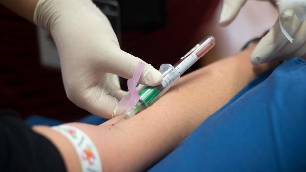 Auch in Südafrika findet eine Studie statt, bei der ein Tuberkulose-Impfstoff (Bild) gegen Coronaviren getestet wird.