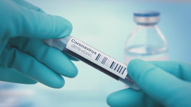 Coronavirus: Antikörpertest von Austro-Forscher nun in Fachjournal