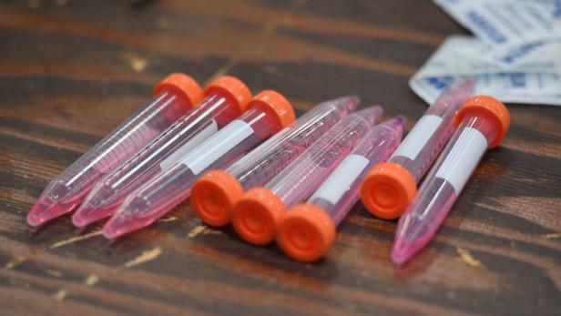 Coronavirus: China testet "vielversprechendes" Antikörper-Medikament
