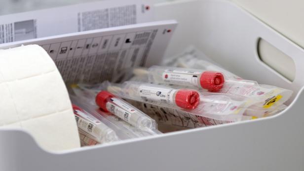 Coronavirus: Südtirol startet breit angelegte Studie zum Virus