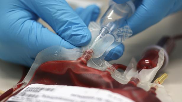 Blutspenden: Bedarf bis 1.000 Konserven pro Tag in Österreich