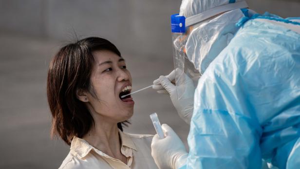 War das Coronavirus bereits im August in China aktiv?