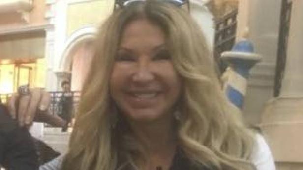 Carmen Geiss: Was ist mit ihrem Gesicht passiert?