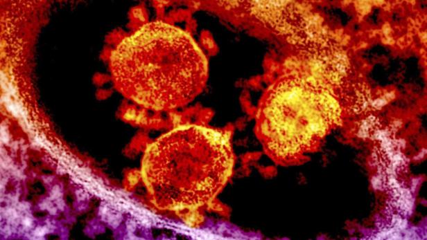 So winzig, so mächtig: Das neuartige Coronavirus hat – aus Virussicht – vieles richtig gemacht