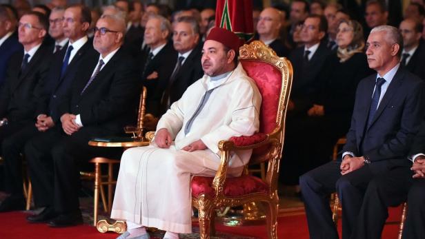 Marokkanischer König am Herzen operiert