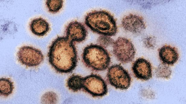 Coronavirus: Vier Prozent der Sterbefälle durch Covid-19