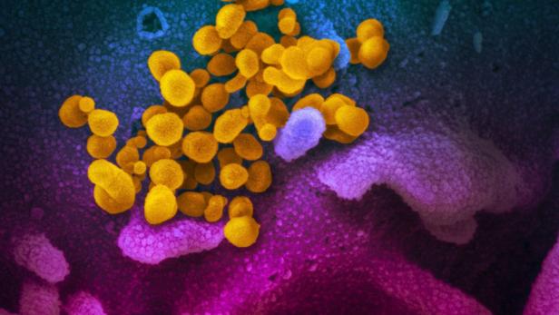 Coronaviren (gelb) dringen in Zellen (violett) ein und vermehren sich in diesen.
