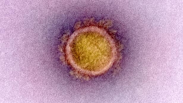 Research on novel coronavirus 2019, National Institutes of Health