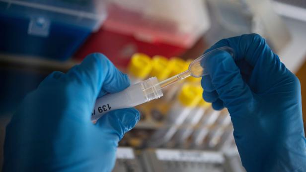 Grippesaison: Deutsche Ärzte warnen vor Labor-Engpässen  