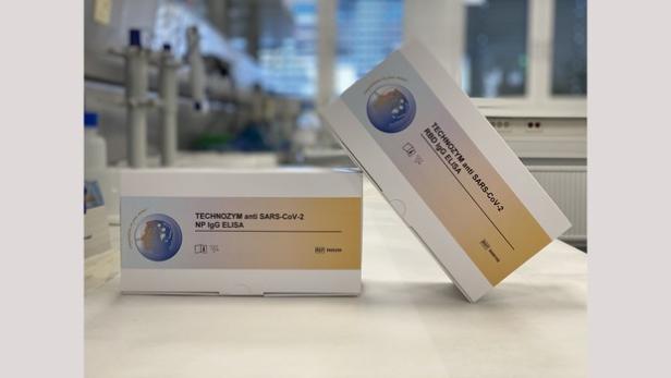 Erster quantitativer SARS-COV-2 Antikörpertest &quot;Made in Austria&quot;. Credits: Veronika Binder/Technoclone