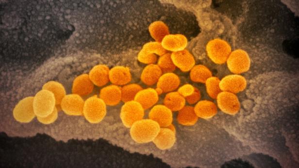 Der Wirkstoff soll Coronaviren (orange) daran hindern, in Zellen (auf dem Bild grau) einzudringen.