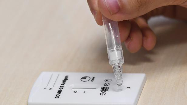 Coronavirus: Hausärzte dürfen testen, doch Tests fehlen