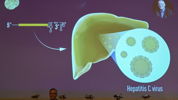 Nobelpreis: So viele Menschen sind von Hepatitis C betroffen