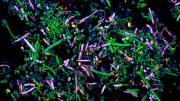 Im Magen-Darm-Trakt von Säugetieren leben hunderte bis tausende verschiedene Mikroorganismen. Dieses Bild aus einem Fluoreszenz-Mikroskop zeigt einige der Mikrobenarten, die im Darm von Mäusen vorkommen.