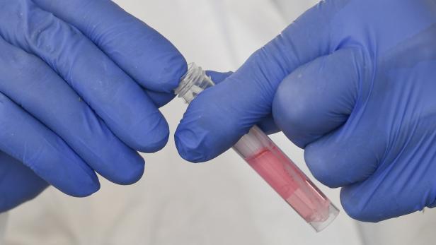 Coronavirus: 13 Mitarbeiter im Landesklinikum Zwettl infiziert