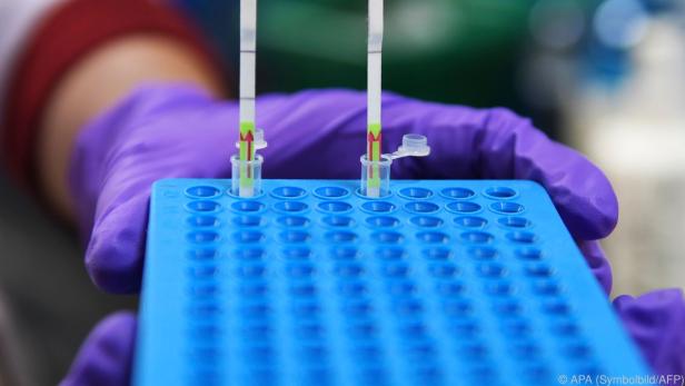 Knapp 17.000 PCR-Tests kamen innerhalb eines Tages hinzu