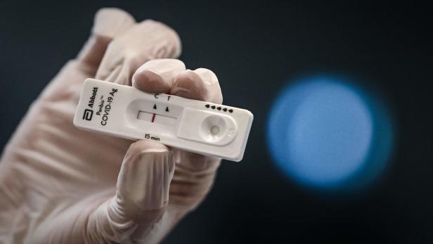 Coronavirus: Apotheke darf keine Antigen-Tests mehr anbieten