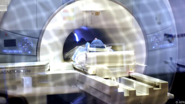 Bestrahlungsplanung mittels MRT erlaubt hochpräzise Tumor-Darstellung