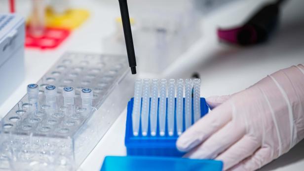 Corona: 53 von 73 Lehrer-PCR-Tests in OÖ positiv