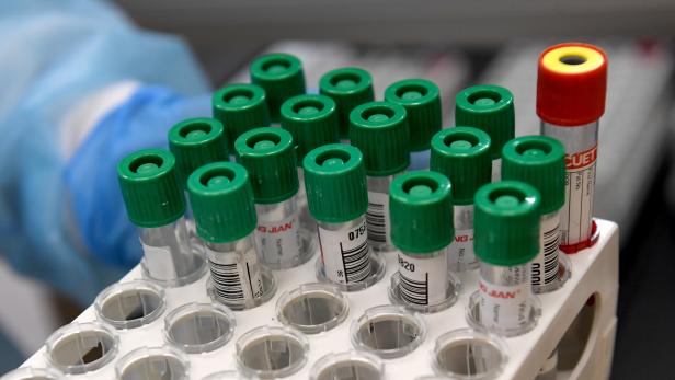 Über zwei Millionen PCR-Tests bei "NÖ gurgelt" ausgewertet