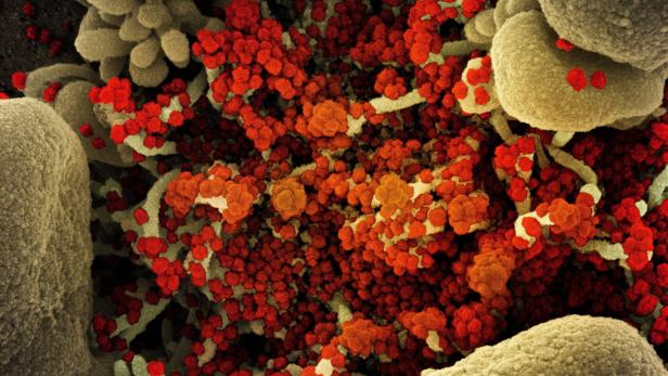 Das Bild zeigt Virus-Partikel (rot), die Zellen infizieren.