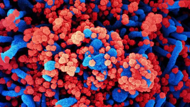 Eine Zelle (blau), die mit dem Coronavirus (rot) infiziert ist.