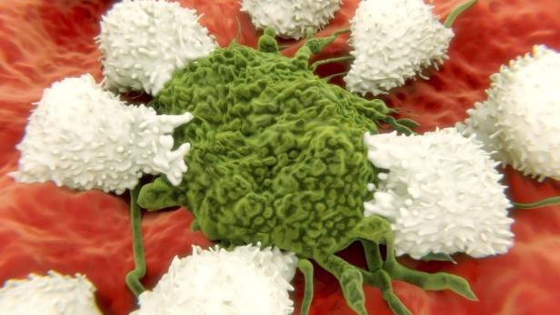 Angriff: Abwehrzellen (weiß) attackieren eine Krebszelle (grün).