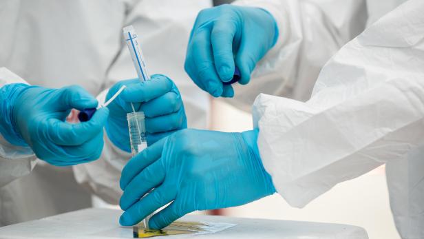 Covid Fighters können Corona-PCR-Tests in rund zwei Stunden liefern
