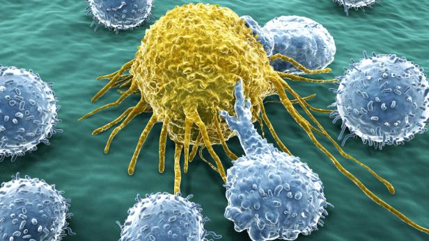Immuntherapien gegen Krebs: "Aufregend und verblüffend"