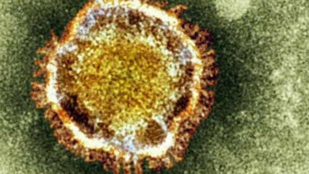 A electron microscope image of a coronavirus is seen in this undated picture provided by the Health Protection Agency in London February 19, 2013. A new virus that emerged in the Middle East last year and has killed five people is well adapted to infecting humans but could potentially be treated with drugs that boost the immune system, scientists said on Tuesday. REUTERS/Health Protection Agency/Handout (BRITAIN - Tags: ANIMALS HEALTH SOCIETY SCIENCE TECHNOLOGY) ATTENTION EDITORS - THIS IMAGE WAS PROVIDED BY A THIRD PARTY. FOR EDITORIAL USE ONLY. NOT FOR SALE FOR MARKETING OR ADVERTISING CAMPAIGNS, NO COMMERCIAL OR BOOK SALES. THIS PICTURE IS DISTRIBUTED EXACTLY AS RECEIVED BY REUTERS, AS A SERVICE TO CLIENTS