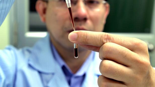 Ein Wissenschaftler tropft eine dunkle Flüssigkeit in ein Röhrchen.