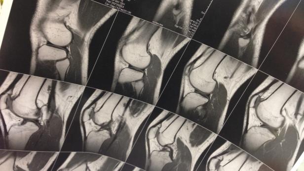 Ein MRT-Scan zeigt das Knie einer Person.