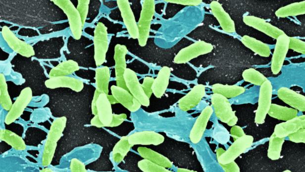In Georgien werden bakterielle Infektionen schon lange mit sogenannten Phagen bekämpft - im Gegensatz zu Antibiotika werden nicht alle Bakterien zerstört, sondern gezielt die schädlichen.