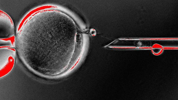 Forscher klonen menschlichen Embryo