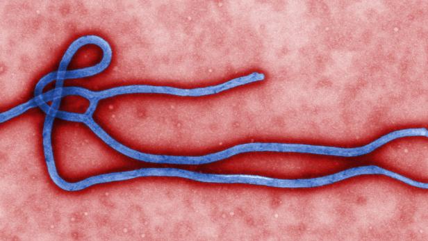Entwarnung bei Ebola-Verdachtsfällen in Österreich