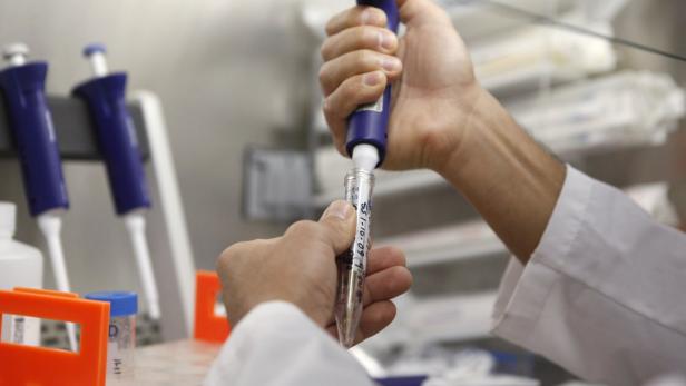 An embryologist prepares cells for reconstruction inside a cloning lab at ViaGen in Austin, Texas November 11, 2009. The U.S. Food and Drug Administration in 2008 approved the sale of food from clones and their offspring, stating the products are indistinguishable from that of their non-clone counterparts. The moves have stirred controversy about whether tinkering with nature is safe, or even ethical, prompting major food companies to swear off food products from cloned animals. But consumers are likely already eating meat and drinking milk from the offspring of clones, which are technically not clones, without even knowing it. To match Special Report FOOD/CLONING Picture taken November 11, 2009. REUTERS/Jessica Rinaldi (UNITED STATES SOCIETY HEALTH SCI TECH FOOD BUSINESS)