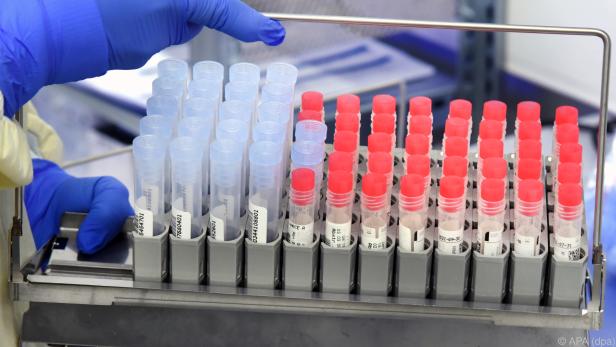 Auch Anteil positiver PCR-Tests angestiegen