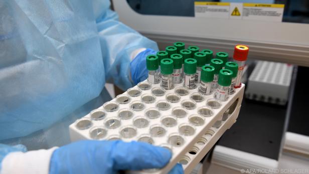 Mehr als zwei Drittel weniger PCR-Tests eingemeldet als üblich