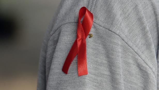 40 Jahre HIV: Vom ersten Aids-Patienten bis zum ersten Medikament