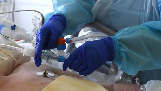 Corona-Patienten belegen die Intensivbetten in Kärnten