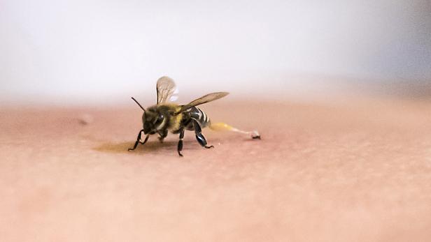 Junger Mann in Ohio 20.000 Mal von Killerbienen gestochen
