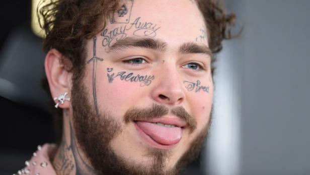 Post Malone hat sich um 1,6 Millionen ein neues Lächeln gegönnt