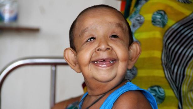 Der vierjährige Bayezid Shikdar im Dhaka Medical College Hospital in Dhaka in Bangladesch