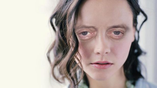 Nahaufnahme des Gesichts einer Frau mit dunklen Ringen unter den Augen.