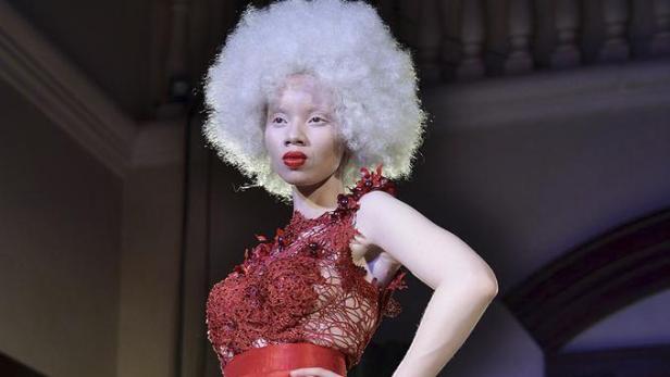 Kopie von CAcfwKrWYAEv9_I.jpg large.jpg Albino-Model kämpft gegen Diskriminierung