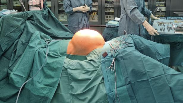 Seltener Fall: Zehn Kilogramm schwerer Tumor bei Kärntnerin entfernt