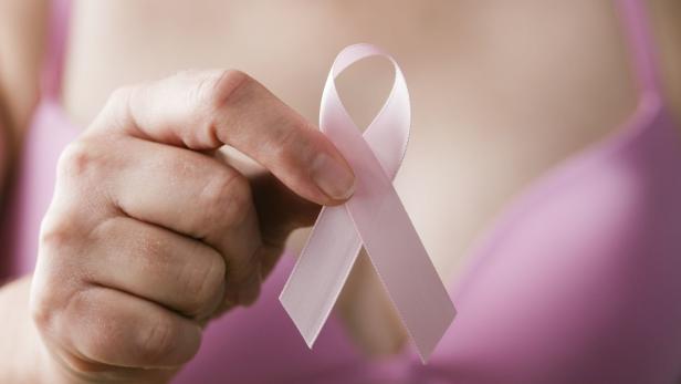 Künstliche Intelligenz bei Brustkrebs-Früherkennung zu ungenau