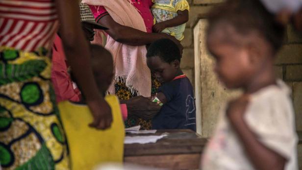 DRCONGO-HEALTH-MEASLES Gefahr von Masern-Ausbrüchen steigt: 685 Todesopfer in Simbabwe