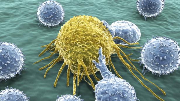 Krebszellle mit Abwehrzellen: Nicht zugelassene Therapien in Alternativzentrum