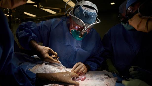 Erstmals erfolgreich Schweineniere in Menschen transplantiert